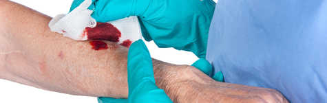 Bloodborne Pathogens Protection (BBP) Bloodborne Pathogens Protection (BBP)